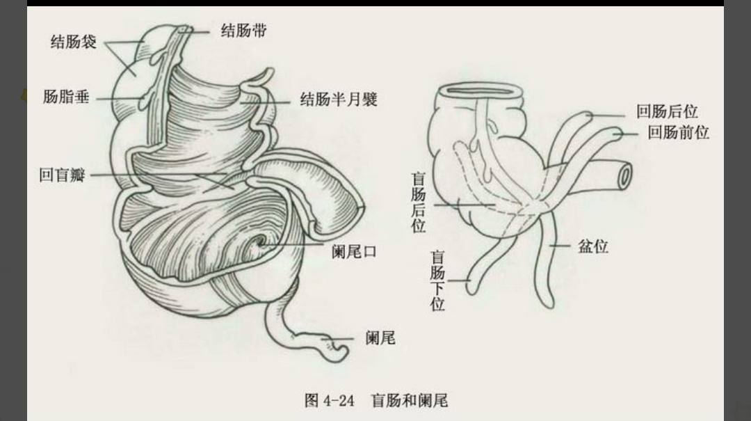 肚脐下方疼痛怎么回事(有可能是这种疾病)